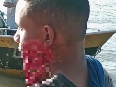 漁師を襲おうとした男がナタで顔面を切り刻まれる