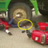 ダンプカーに足を潰された男性（中国）